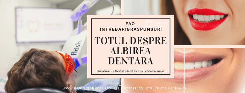 etape albire dentara davinci dental clinic